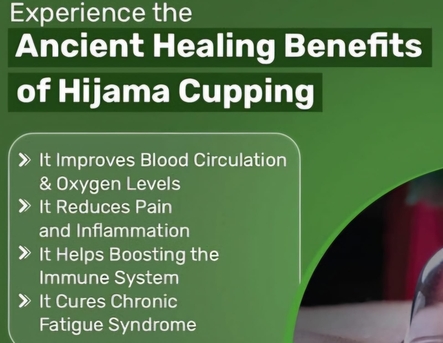 🌿 Heal Your Body. Revive The Sunnah. With Hijama Therapy 🌿 photo 1
