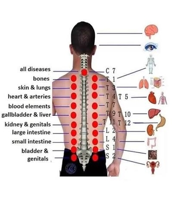 Hijama (Cupping Therapy) photo 2